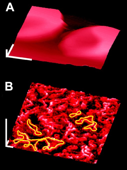 低温原子力显微成像系统应用实例 —— 兔红细胞表面